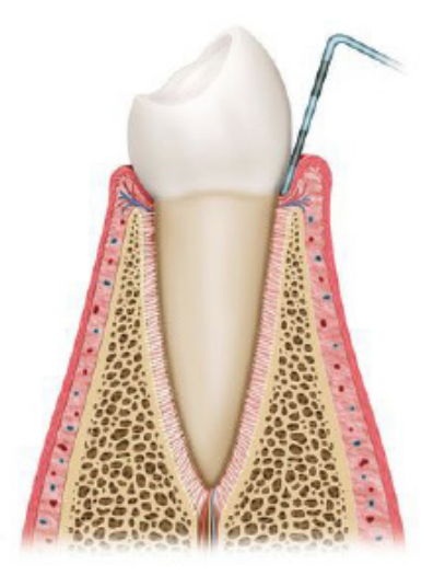 Stage1
